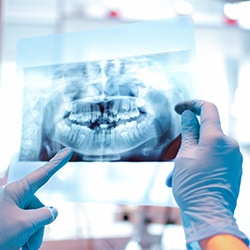 Dentist with blue gloves examining patient X-ray