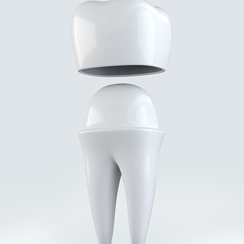Illustration of a tooth and a dental crown in Minot, ND