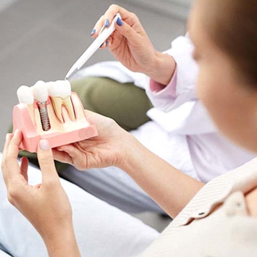 dental implant dentist in Minot showing an implant model to a patient