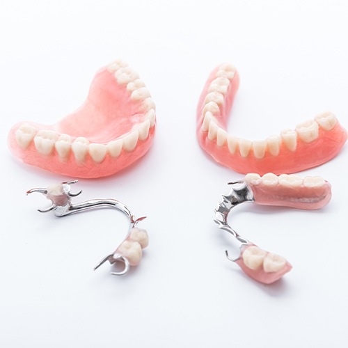 Four types of dentures