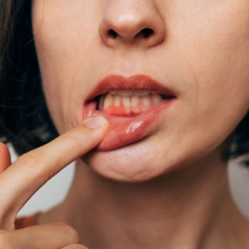 Lady shows gum tissue