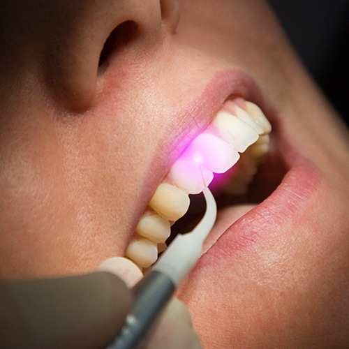 Patient receiving soft tissue laser dentistry treatment