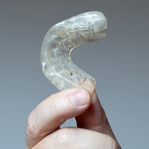 Hand holding an occlusal splint