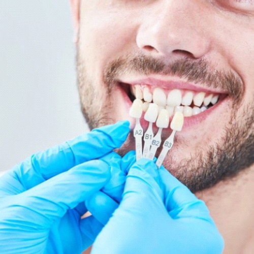 man being fitted with veneers 