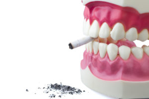 Model of teeth holding burnt cigarette 