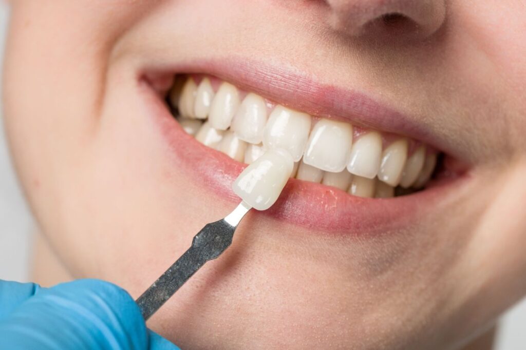 A woman getting veneers