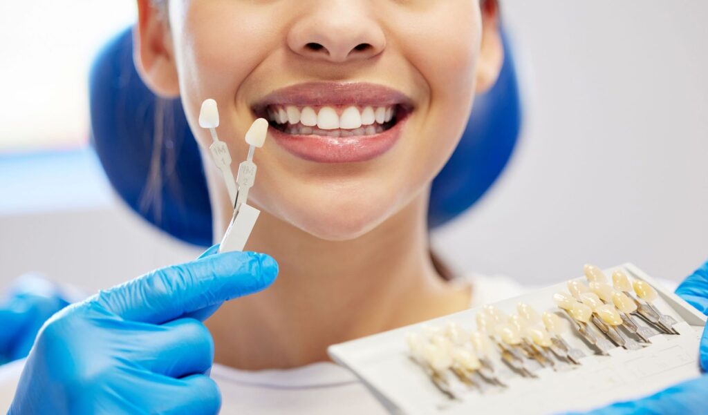 Nose-to-neck view of woman smiling with shade guide held to teeth