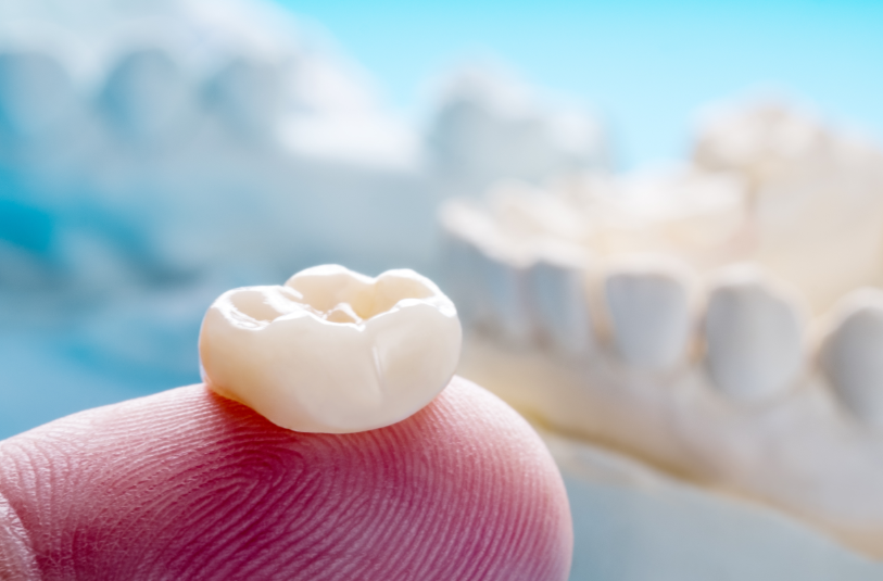 Dental crown on fingertip